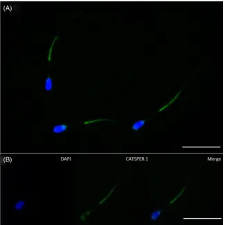 Figure 6. The effect of Mibefradil treatment on (A) hyperactivation and (B) rheotactic response of bull sperm