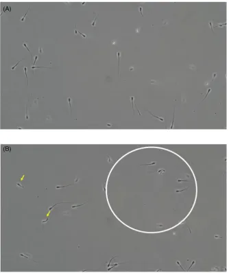 Figure 7. The effect of CATSPER1 antibody on (A) hyperactivation and (B) rheotactic response of bull sperm