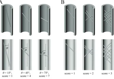 Figure 13 Schematic illustration of two of the features of diaphyseal cancellous bone that weresubject to categorical scoring