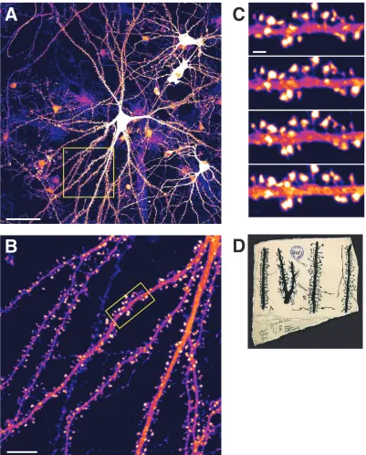 Figure 1-1. Representative pyramidal neuron from rat hippocampus showing 