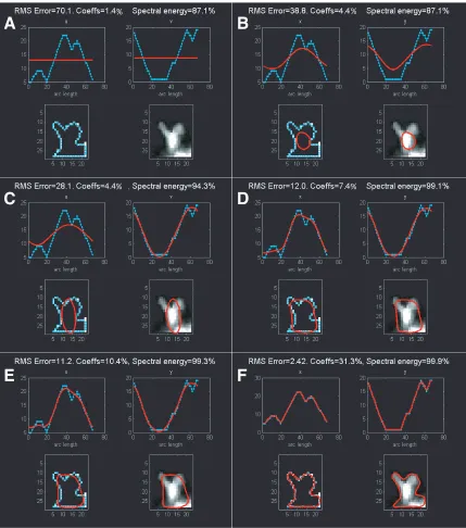 Figure 2-6. Summarizing spine shape with EFFs – example 2. 