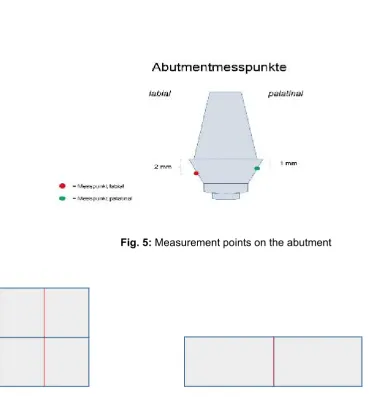 Fig. 5: Measurement points on the abutment 