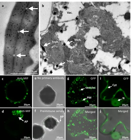 Figure S1. (a,b) Immunogold-labelled electron micrographs of L. polyedra. (a) Representative section of the apical pore showing an important accumulation of gold particles (black dots)