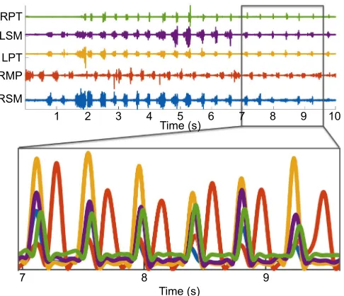 Fig. 3. EMG of a feeding sequence from the FEED database (www.feedexp.org) for the medial pterygoids (MP)