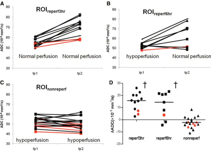 Figure 4. Risk of infarction in the 3 ROIs (box ⫽25th to 75th per- per-centile; bars ⫽10th to 90th percentile)