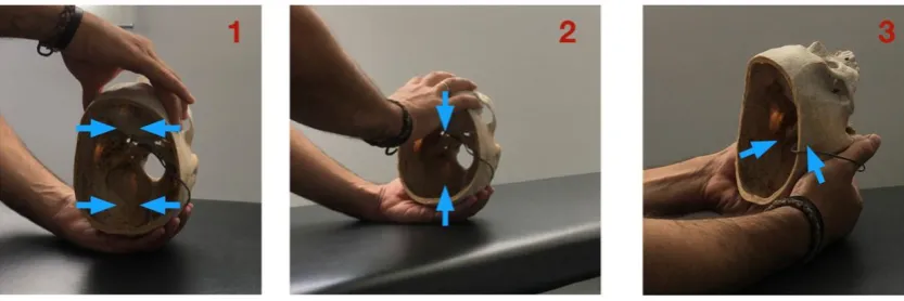 Figure 1. Location of the gauge at the base of the skull. 