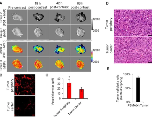 Figure 8. Imaging intra-tumoral MNP and vascular distribution patterns. A) T 2 -W MRIs (grayscale and colored) of the intra-tumoral signal change patterns of representative  PSMA(+) PC3 PIP tumors from Group 2 and Group 3 mice, respectively