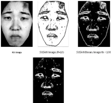 Figure 1. Mis-localization of right Eyebrow segment using Novel FGA method 