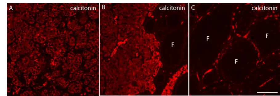 Figure 2. Immunofluorescence labeling for calcitonin on semi-thick sections of the MTC nodule