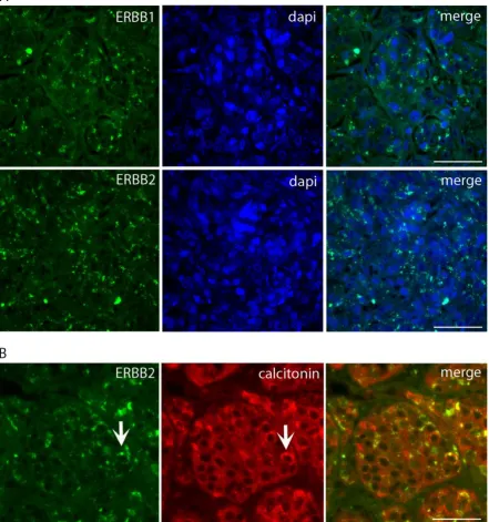 Figure 3. Immunofluorescence labeling for ERBB1 and ERBB2 on semi-thick sections of the MTC nodule
