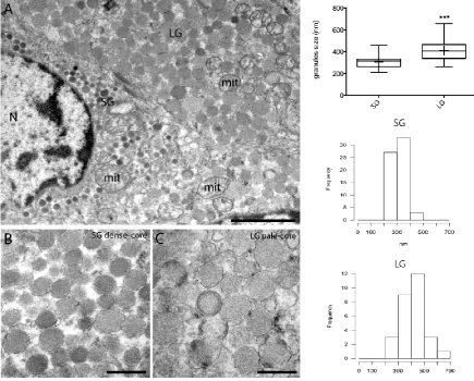Figure 4. Representative TEM micrographs of MTC. A. Two adiacent cells containing small dense cored granules (SG) and large pale-cored granules (LG)