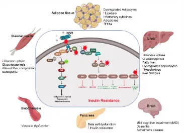 Figure 2.  The pathological effect and consequence of insulin resistance (IR).  Genetic alterations and mutations in the insulin signaling pathway can lead to IR in the insulin-target tissues