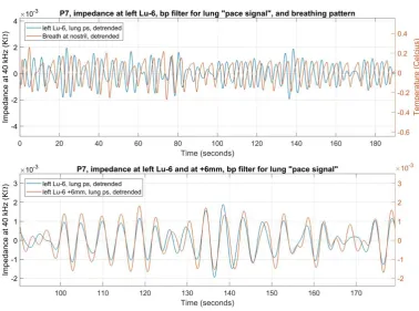 Figure 2. Shows the impedance at left LU-6 on patient 7, while relaxed. The upper plot superimposes the 