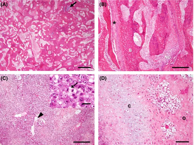 Figure 3. H&E stained sections of a multilobular tumor of bone removed during the ﬁrst surgery (A and B) and during postmortem examinationafter tumor regrowth was observed (C and D)