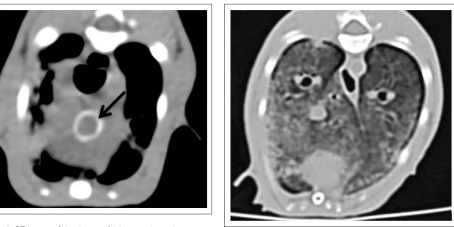 Figure 1 CT image of the thorax of a hypercalcaemic cat (case 1) revealed circumferential mineralisation of the aortic root (arrow)