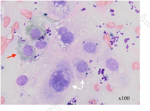 Figure 2. Cytology from Case 1: 2.1 shows multinucleate cells (black arrows) with variable pigmentation (red arrow)