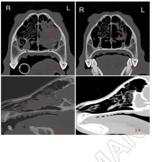 Figure 3. Pre-treatment and post-treatment CT images of Case 2. 3.1: Pre-treatment transverse; 3.2: post-treatment transverse; 3.3 pre-treatment longitudinal; 3.4: post-treatment longitudinal