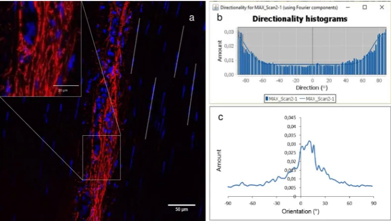 Figure 7. Pictorial representation of the method used to determine the distribution of elastin fibre alignment within histological sections