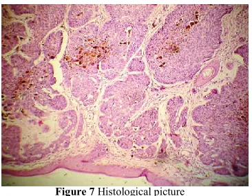 Figure 7 Histological picture 