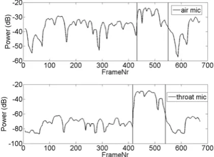 Figure 2 shows an example of the power (in the frequency band used) of the signals of the two microphones in the case of an interfering speaker