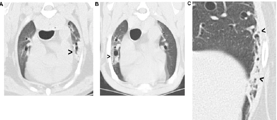 Figure 1. Examples of pulmonary collapse.  A) Collapse of the ventral tip of the left cranial lobe 