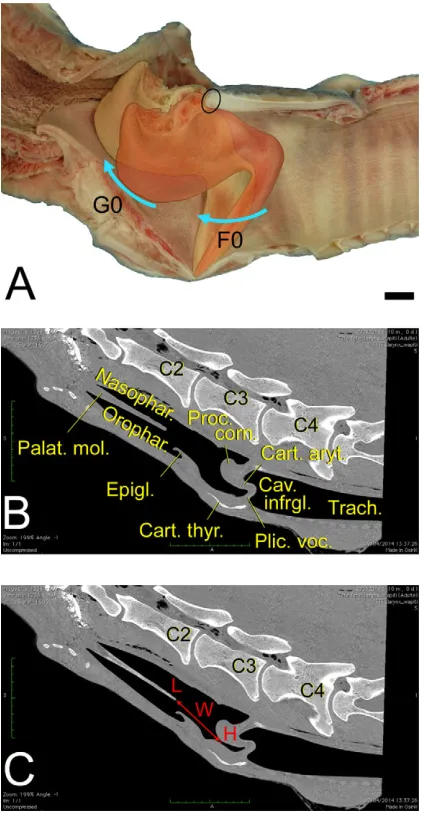 Fig. 8. Flute model of G0 production. (A) Overlay of resting position andphonatory position of the right vocal fold to illustrate the two sources in the flutemodel
