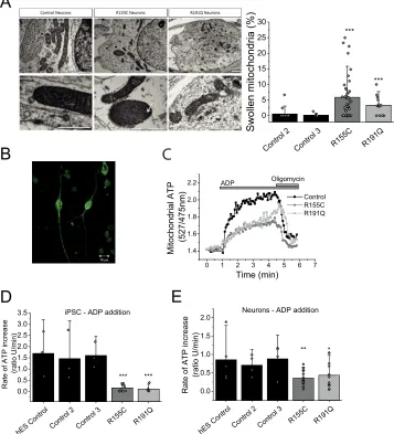 Figure 4. Arepresentative traces of mitochondrial ATP after ADP application. Oligomycin was applied as a negative control., i, transmission electron microscopy images of mitochondria within control and mutant iPSC-derived neurons at day 80 of differentiati