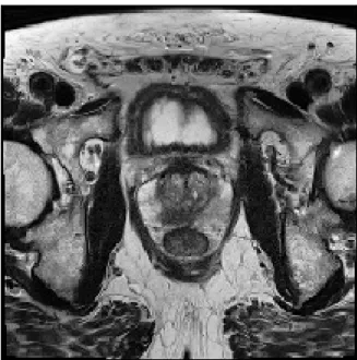 Figure 2.1: T2W slice extracted from patient #29