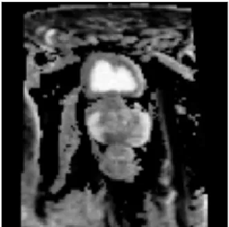 Figure 2.2: ADC slice extracted from patient #29