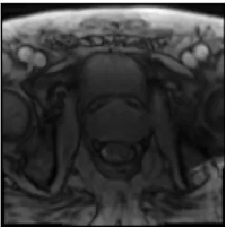 Figure 2.3: PD slice extracted from patient #29