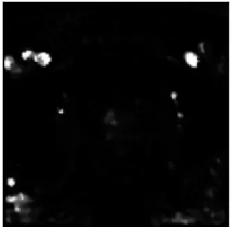Figure 2.4: K-trans slice extracted from patient #29