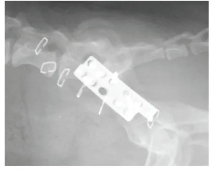 Figure 3: Parallel double plated ilial fracture. Based on the dog’s weight a 2.7mm plate 
