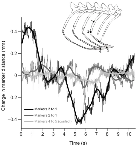 Fig. 5. Relative motion of vertebral and sternal rib segments during arepresentative deep breath.shown (mean marker tracking precision for this study is ±0.1 mm)