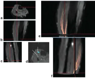 Fig. 7. Haxton’to explain that the physiological cross-sectional area of a muscle is the sum of anumber of cross-sectional areas sectioning all muscle fibres at right angles(s illustration of a pennate muscle