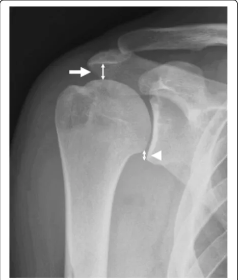 Fig. 1 a After arthroscopic rotator cuff repair, the tendon covered more than 50% of the anatomical footprint in completely repaired group