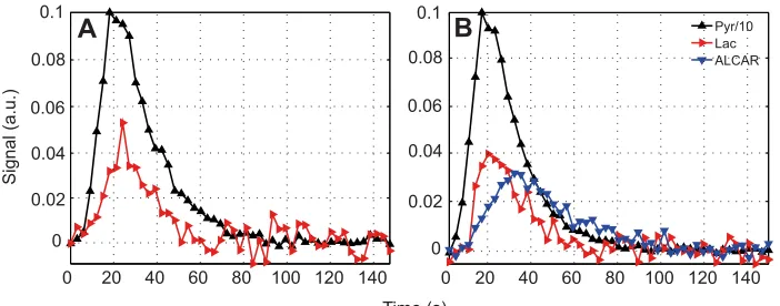 Fig. 3. Time-averaged 13C signals from ratskeletal muscle after injection of 80 mmol l−1hyperpolarized [2-13C]pyruvate