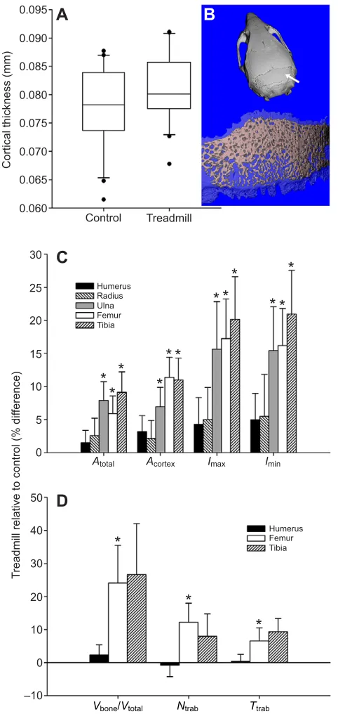 Fig. 3. Skeletal adaptation to treadmill exercise was site-specific.(A) Interparietal cortical bone thickness among controls and treadmill runners.A(D) trabecular properties between controls and runners.Boxes are median±first and third quartile; whiskers, 