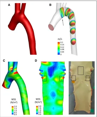 Figure 2. Steady state fluid dynamics in the porcine aorta. Steady state fluid dynamics in the porcine aorta were studied using magnetic resonance (MR) imaging and computational fluid dynamics