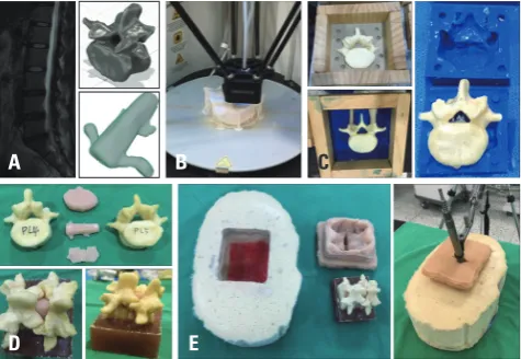 Fig. 3. New endoscope-assisted spine surgery system with an additional working portal