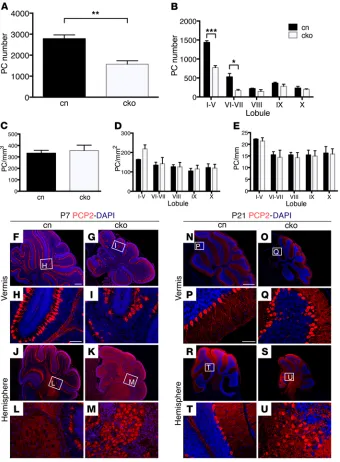 Figure 3. Deletion of Chd7length of the PC layer (mm) (test. (sections through the vermis (left