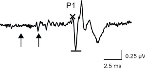 Fig. 3. Examples of paired-click stimuli and auditory brainstemresponses (ABRs). Subjects were tested with pairs of acoustic clicks thatvaried in inter-click interval (ICI)