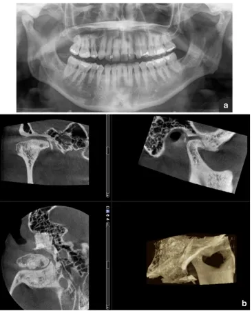 Fig. 9 CBCT examination combined with 3D photography. (Courtesy of the manufacturer. The image is shown with the patient's permission)
