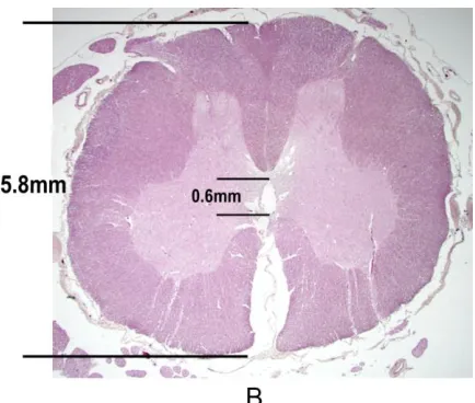 Figure 4. A) Transverse image of the spinal cord acquired using the same spatial resolution as series A
