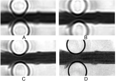 Figure 5. Examples of T2w MR images of unfixed, focally compressed spinal cord in a saline bath 