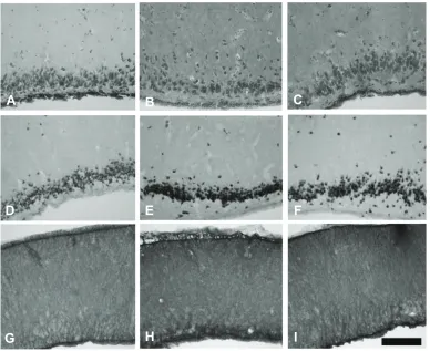 Fig. 1. Analysis of the cortex ofthe turtle for neuronal damage.(A–C) Cresyl Violet staining