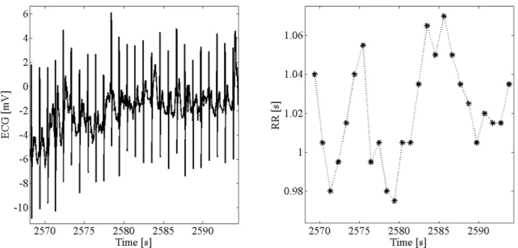 Figure 1.1: ECG trace (left) and the corresponding RR intervals (right).