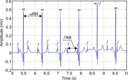 Figure 7. Primary input to the adaptive system (filter). A synthetic aECG signal generated by our signal generator and recorded by abdominal electrode AE002.