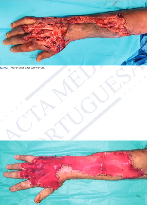 Figure 2 – Presentation after debridement
