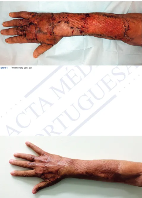 Figure 4 – Two months post-op