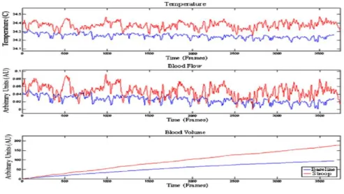 Figure 4-7 Shows the result of the strooping test performed by the Texas group: (Top) The forehead  temperatures  measured  by  TI  technique  showing  an  elevated  temperature  in  the  region  throughout  the test (red) comparing to the base line (blue)